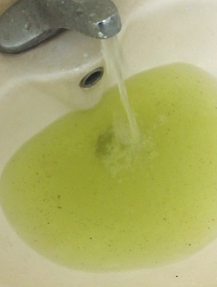 高週波洗管After