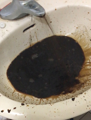 高週波洗管Before